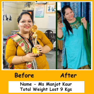 Before and after weight loss transformation of a Nutrition360 client following a personalized diet plan under the guidance of an expert dietitian in Greater Noida. Individual results may vary.